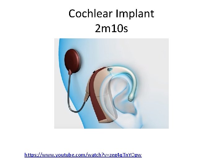 Cochlear Implant 2 m 10 s https: //www. youtube. com/watch? v=zeg 4 q. Tn.