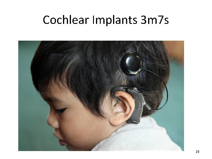 Cochlear Implants 3 m 7 s 23 