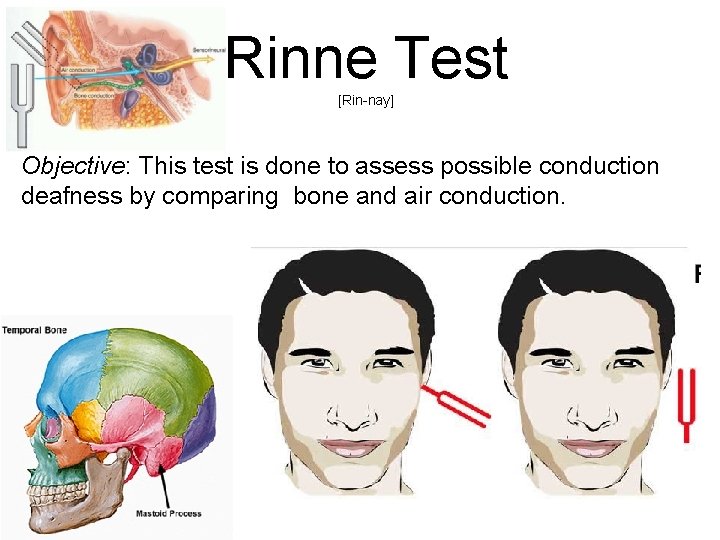 Rinne Test [Rin-nay] Objective: This test is done to assess possible conduction deafness by