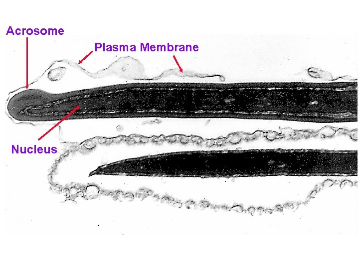 Acrosome Plasma Membrane Nucleus 