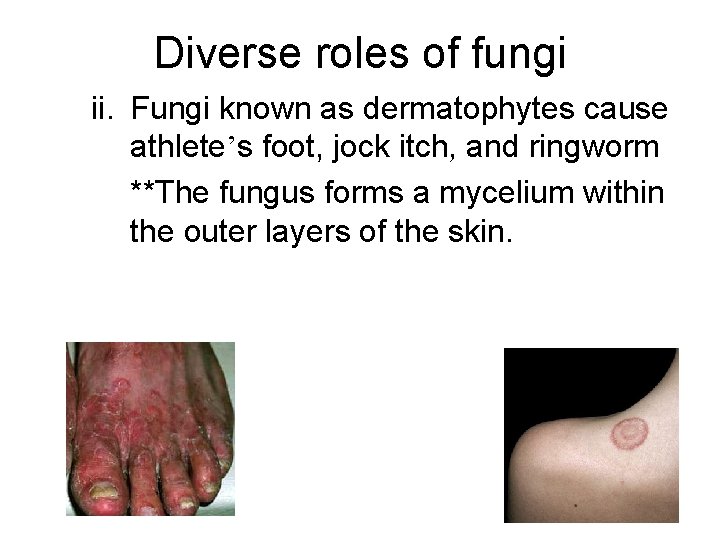 Diverse roles of fungi ii. Fungi known as dermatophytes cause athlete’s foot, jock itch,