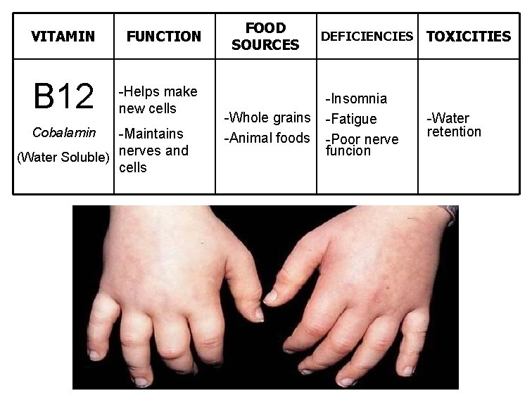 VITAMIN B 12 Cobalamin FUNCTION -Helps make new cells -Maintains (Water Soluble) nerves and