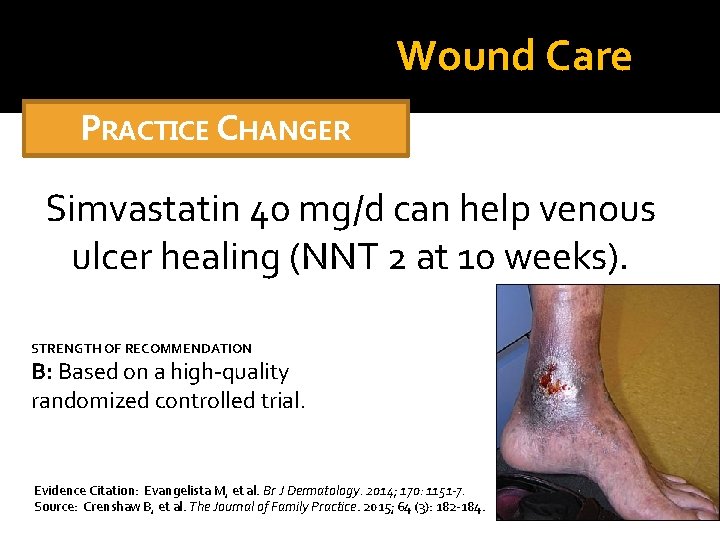 Wound Care PRACTICE CHANGER Simvastatin 40 mg/d can help venous ulcer healing (NNT 2