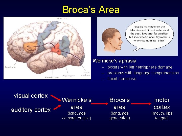 Broca’s Area Wernicke’s aphasia – occurs with left hemisphere damage – problems with language