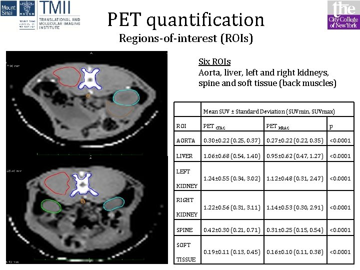 PET quantification Regions-of-interest (ROIs) Six ROIs Aorta, liver, left and right kidneys, spine and PET quantification Regions-of-interest (ROIs) Six ROIs Aorta, liver, left and right kidneys, spine and