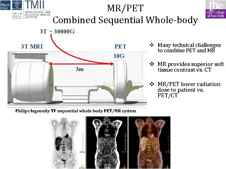 MR/PET Combined Sequential Whole-body 3 T = 30000 G 3 T MRI PET 10