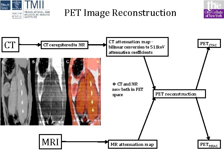 PET Image Reconstruction CT CT coregsitered to MR CT attenuation map - bilinear conversion PET Image Reconstruction CT CT coregsitered to MR CT attenuation map - bilinear conversion