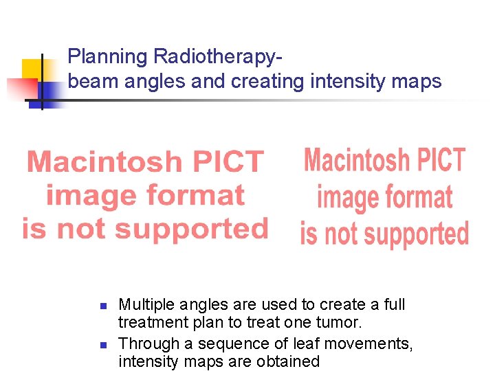 Planning Radiotherapybeam angles and creating intensity maps n n Multiple angles are used to