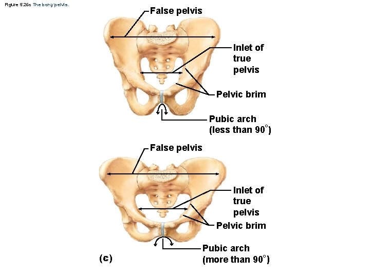 Figure 5. 26 c The bony pelvis. False pelvis Inlet of true pelvis Pelvic