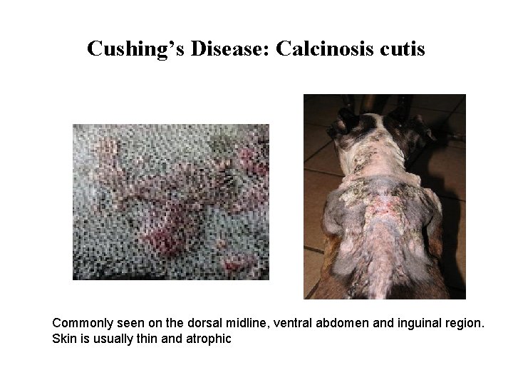 Cushing’s Disease: Calcinosis cutis Commonly seen on the dorsal midline, ventral abdomen and inguinal