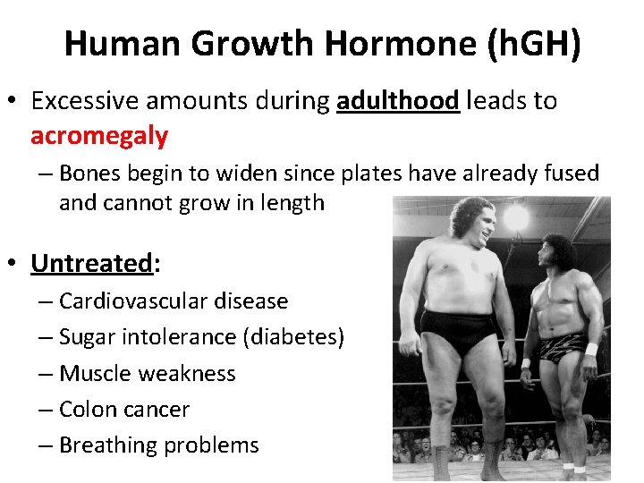 Human Growth Hormone (h. GH) • Excessive amounts during adulthood leads to acromegaly – Human Growth Hormone (h. GH) • Excessive amounts during adulthood leads to acromegaly –