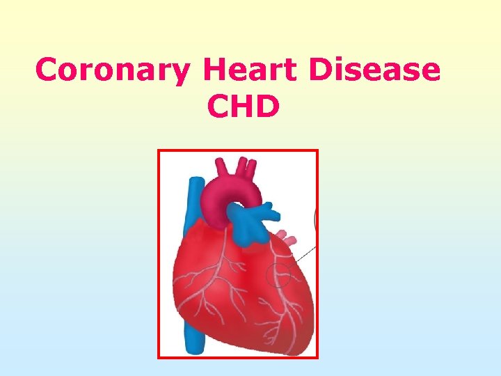 Coronary Heart Disease CHD 