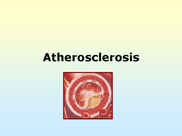 Atherosclerosis 