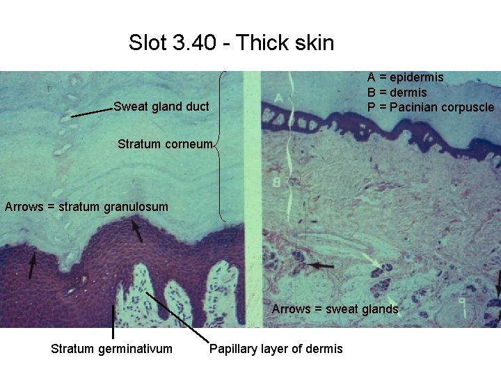 Slot 3. 40 - Thick skin A = epidermis B = dermis P =