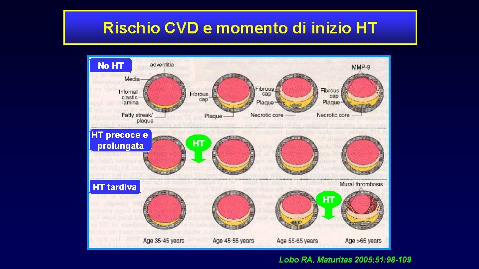 Rischio CVD e momento di inizio HT No HT HT precoce e prolungata HT