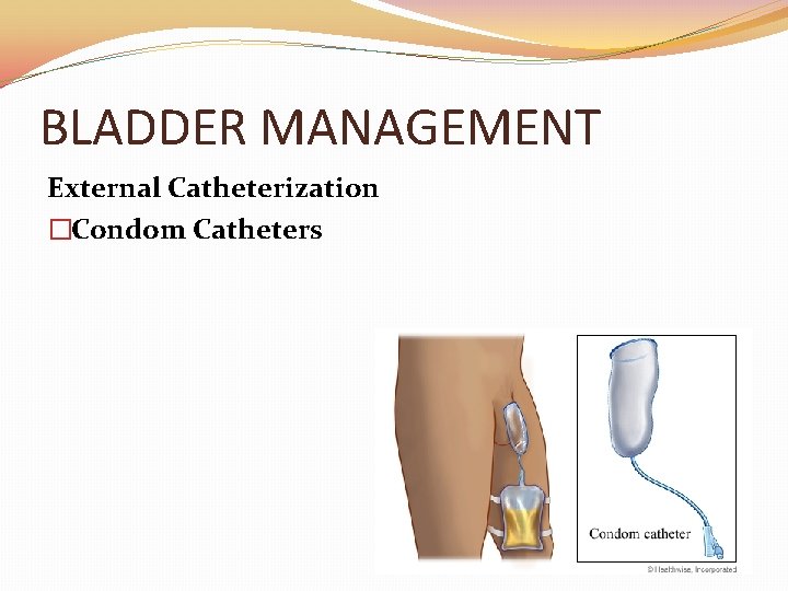 BLADDER MANAGEMENT External Catheterization �Condom Catheters 