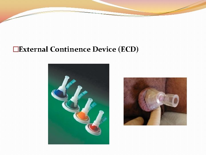 �External Continence Device (ECD) 