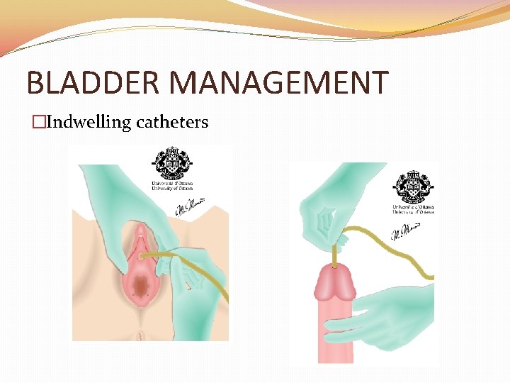 BLADDER MANAGEMENT �Indwelling catheters 