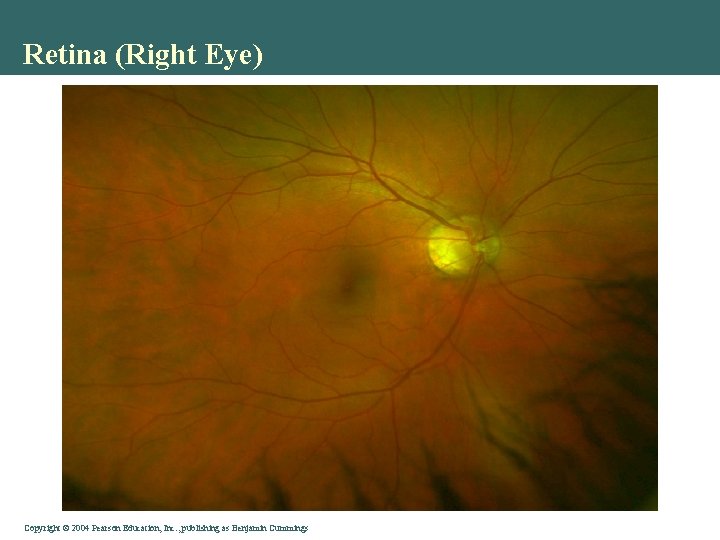 Retina (Right Eye) Copyright © 2004 Pearson Education, Inc. , publishing as Benjamin Cummings