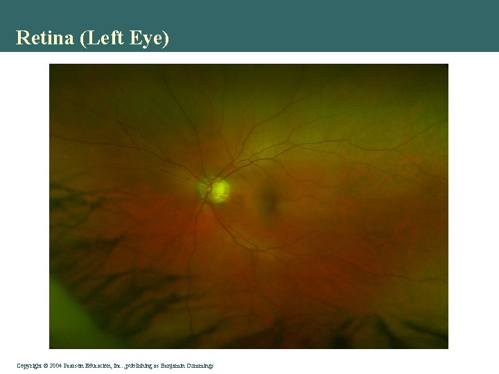 Retina (Left Eye) Copyright © 2004 Pearson Education, Inc. , publishing as Benjamin Cummings