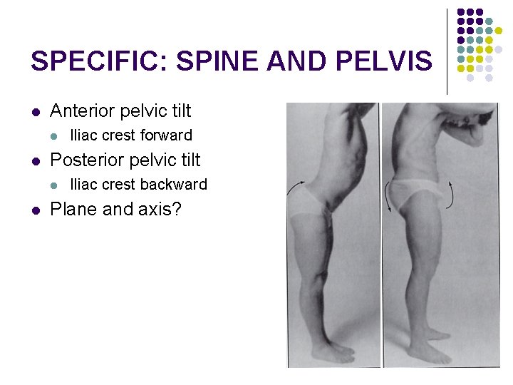 SPECIFIC: SPINE AND PELVIS l Anterior pelvic tilt l l Posterior pelvic tilt l