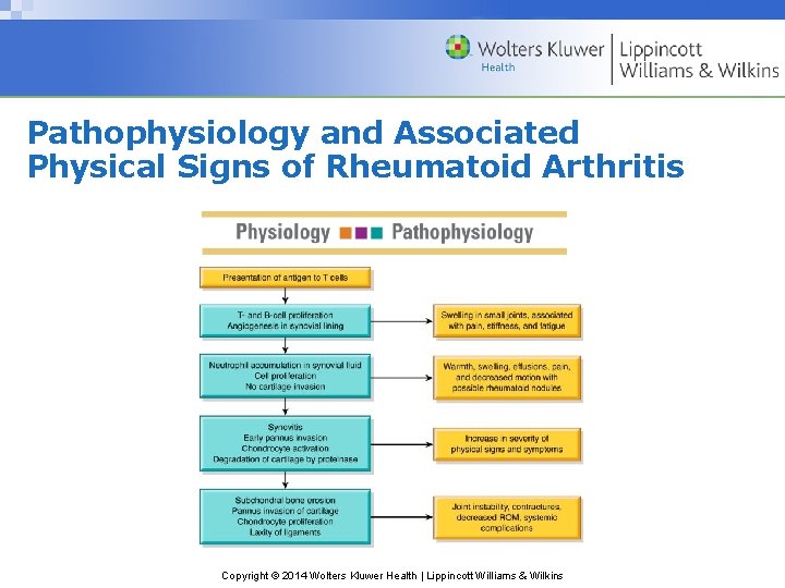 Pathophysiology and Associated Physical Signs of Rheumatoid Arthritis Copyright © 2014 Wolters Kluwer Health