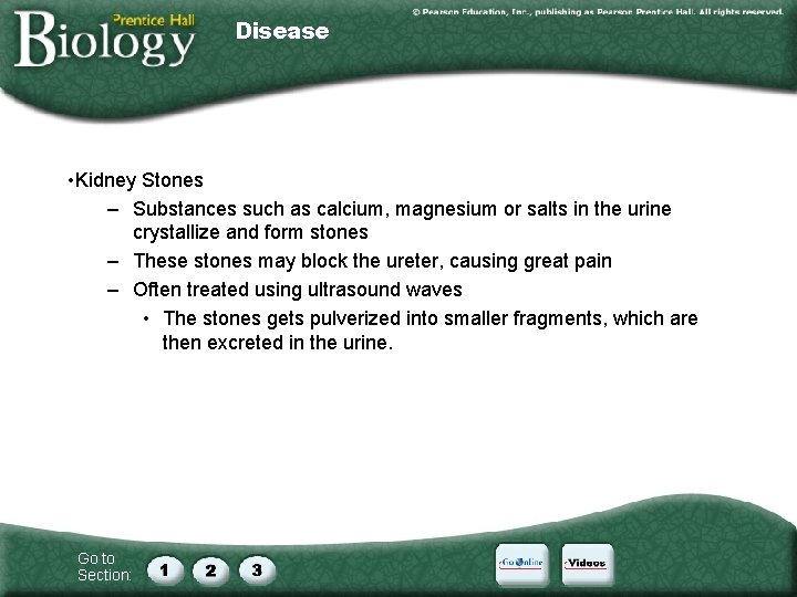 Disease • Kidney Stones – Substances such as calcium, magnesium or salts in the