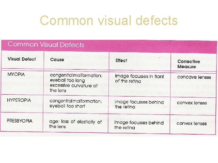 Common visual defects 