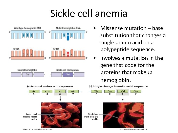 Sickle cell anemia • Missense mutation – base substitution that changes a single amino