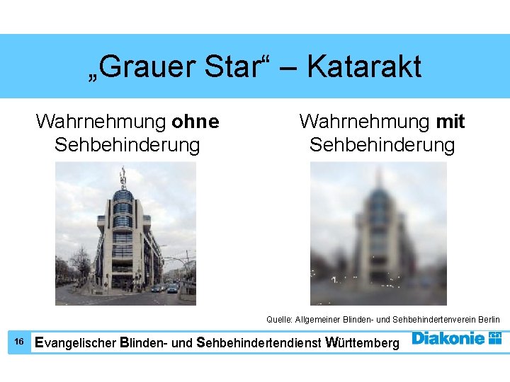 „Grauer Star“ – Katarakt Wahrnehmung ohne Sehbehinderung Wahrnehmung mit Sehbehinderung Quelle: Allgemeiner Blinden- und