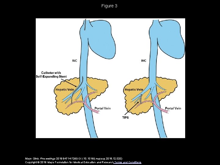 Figure 3 Mayo Clinic Proceedings 2019 94714 -726 DOI: (10. 1016/j. mayocp. 2018. 12.