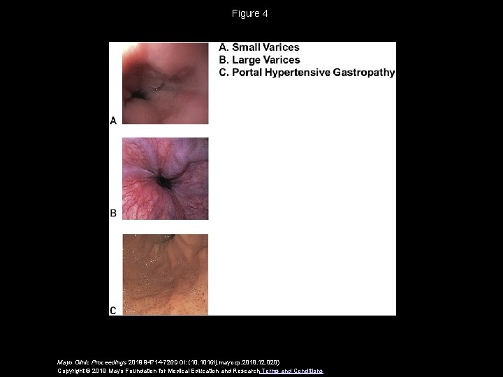 Figure 4 Mayo Clinic Proceedings 2019 94714 -726 DOI: (10. 1016/j. mayocp. 2018. 12.