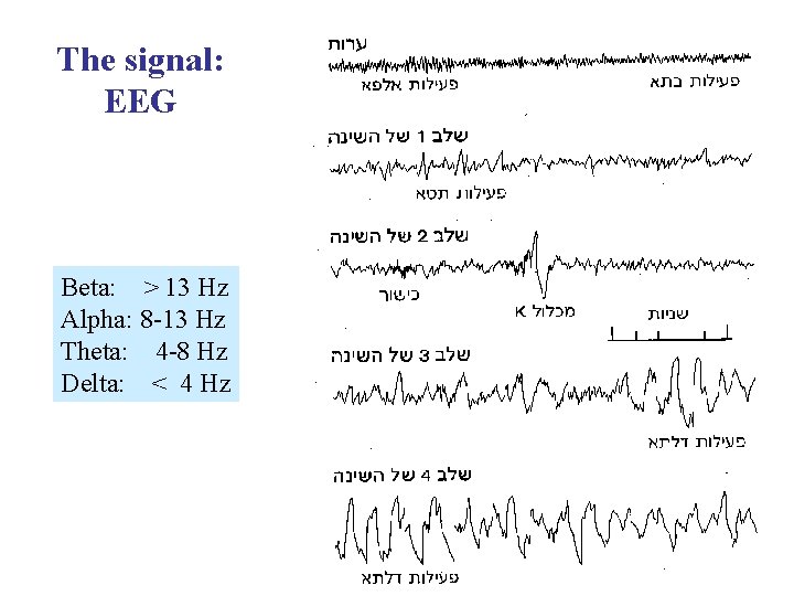 The signal: EEG Beta: > 13 Hz Alpha: 8 -13 Hz Theta: 4 -8
