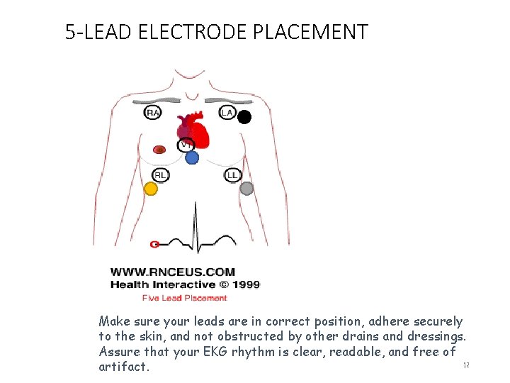 5 -LEAD ELECTRODE PLACEMENT Make sure your leads are in correct position, adhere securely
