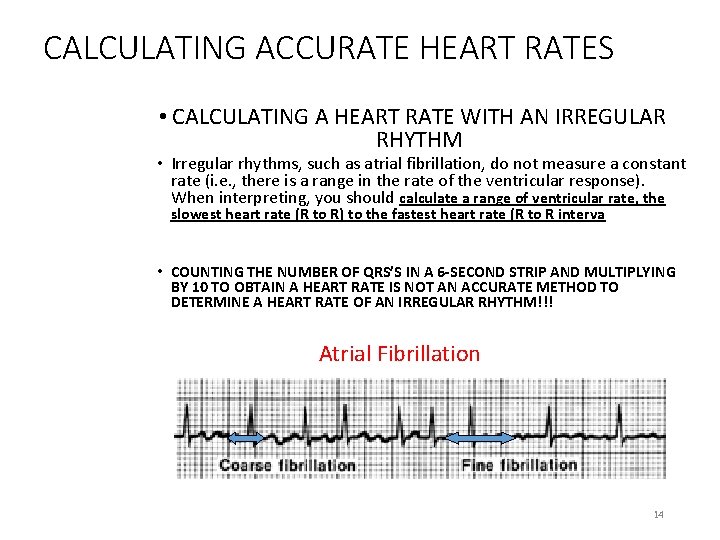 CALCULATING ACCURATE HEART RATES • CALCULATING A HEART RATE WITH AN IRREGULAR RHYTHM •