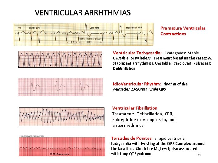 VENTRICULAR ARRHTHMIAS Premature Ventricular Contractions Ventricular Tachycardia: 3 categories: Stable, Unstable, or Pulseless. Treatment
