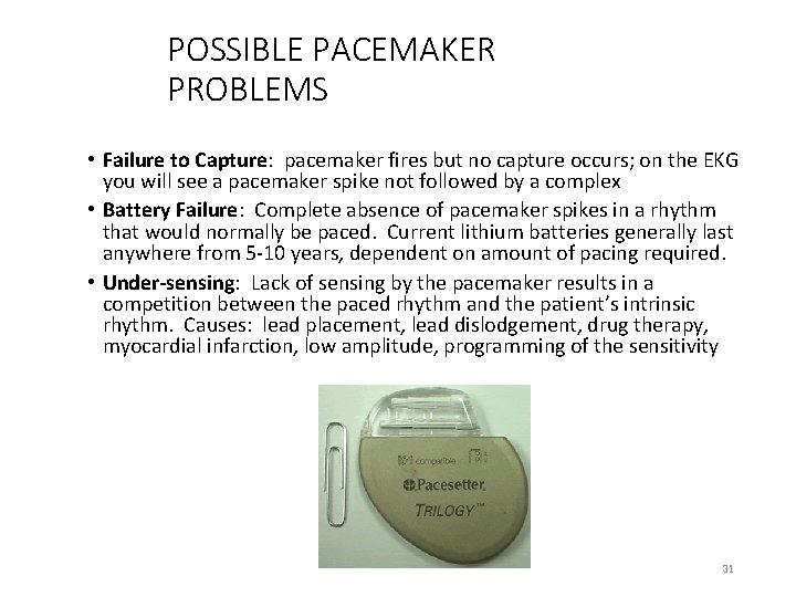POSSIBLE PACEMAKER PROBLEMS • Failure to Capture: pacemaker fires but no capture occurs; on