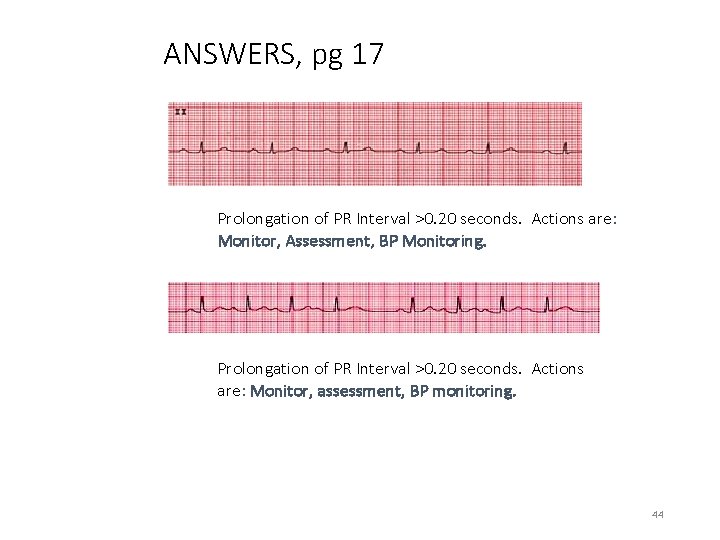 ANSWERS, pg 17 Prolongation of PR Interval >0. 20 seconds. Actions are: Monitor, Assessment,