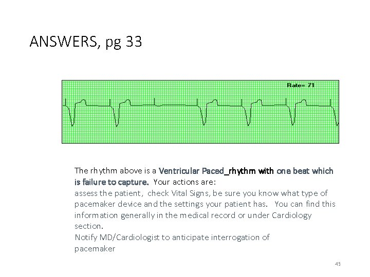 ANSWERS, pg 33 The rhythm above is a Ventricular Paced_rhythm with one beat which