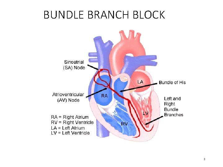BUNDLE BRANCH BLOCK 8 