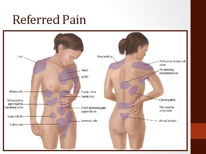 Referred Pain 
