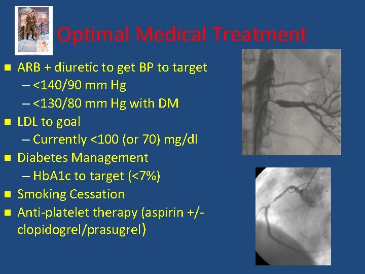 Optimal Medical Treatment ARB + diuretic to get BP to target – <140/90 mm