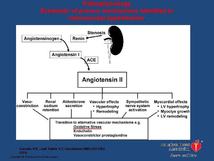 Pathophysiology Schematic of pressor mechanisms identified in renovascular hypertension. Garovic V D , and