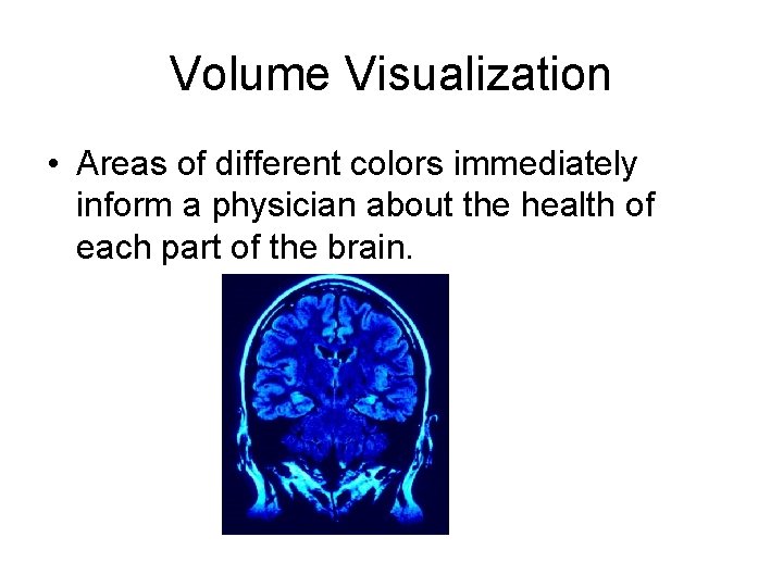 Volume Visualization • Areas of different colors immediately inform a physician about the health Volume Visualization • Areas of different colors immediately inform a physician about the health