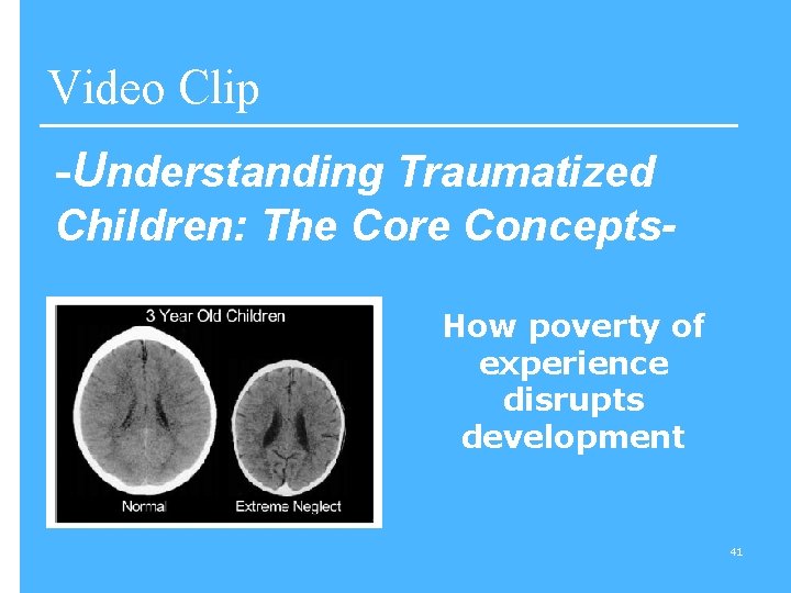 Video Clip -Understanding Traumatized Children: The Core Concepts. How poverty of experience disrupts development