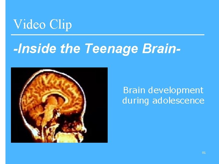 Video Clip -Inside the Teenage Brain development during adolescence 81 