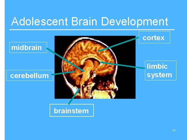 Adolescent Brain Development cortex midbrain limbic system cerebellum brainstem 83 