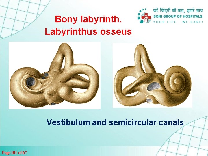 Bony labyrinth. Labyrinthus osseus Vestibulum and semicircular canals Page 101 of 67 