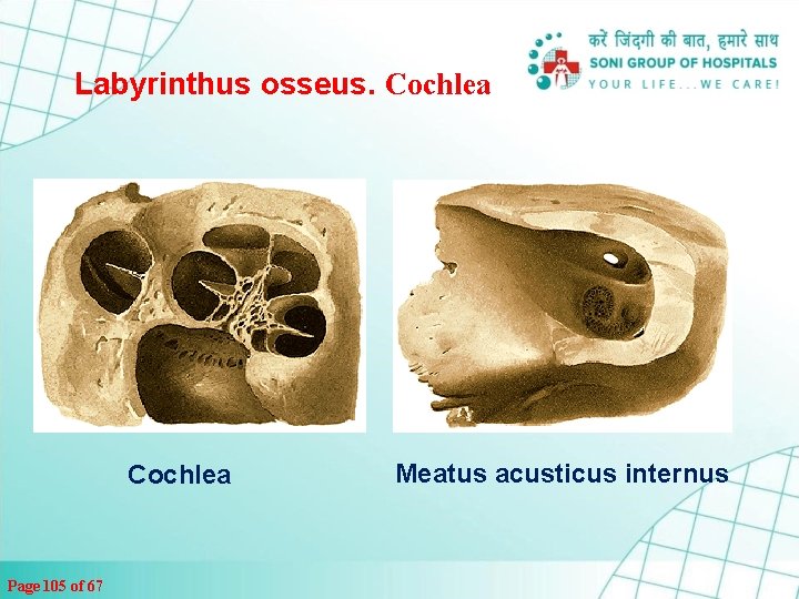 Labyrinthus osseus. Cochlea Page 105 of 67 Meatus acusticus internus 