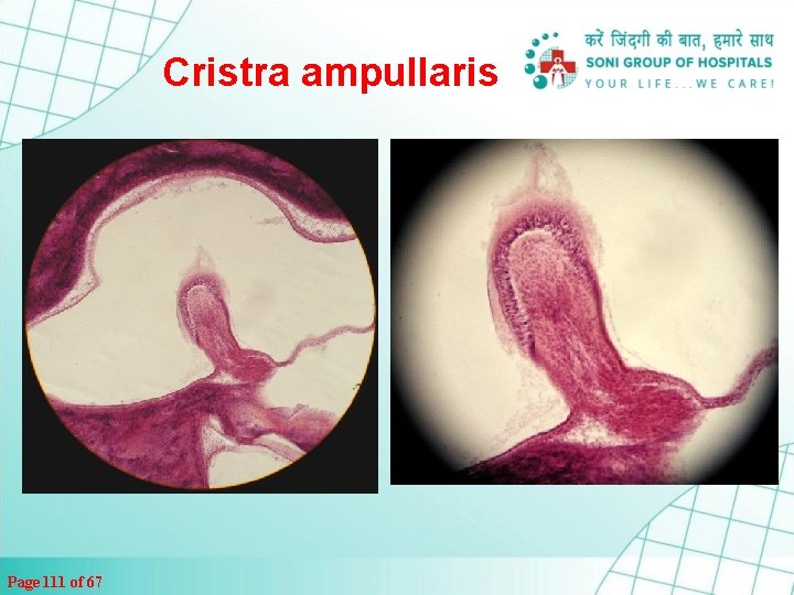 Cristra ampullaris Page 111 of 67 